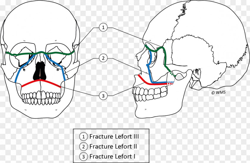 Ear Jaw Bone PNG