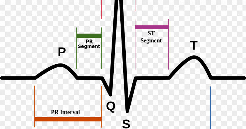 Heart Electrocardiography Rate Pulse Diagram PNG