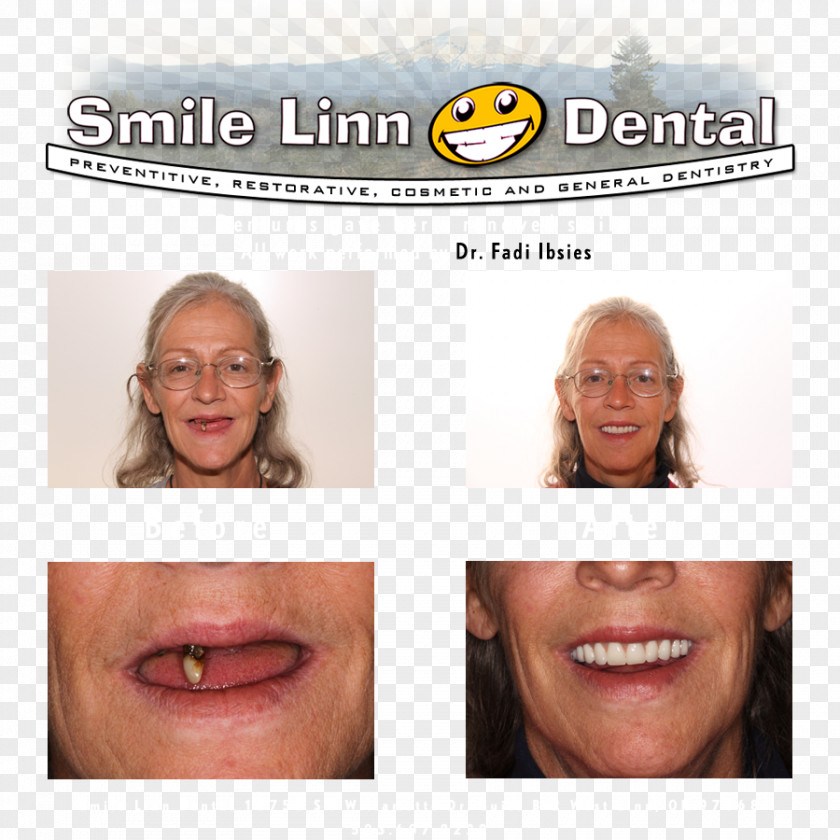 Smile Dental Linn Dental: Ibsies Fadi B DMD Dentistry Lake Oswego Mouth PNG