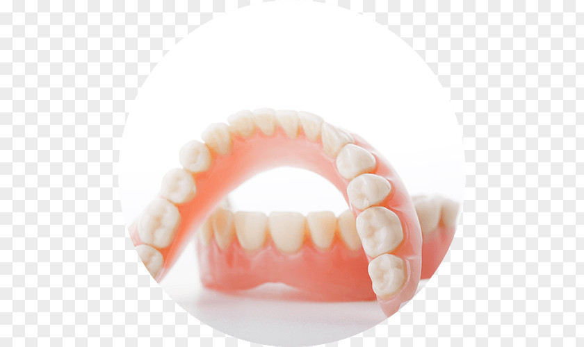 Bridge Dentistry Dentures Southwood Dental Studio Tooth PNG