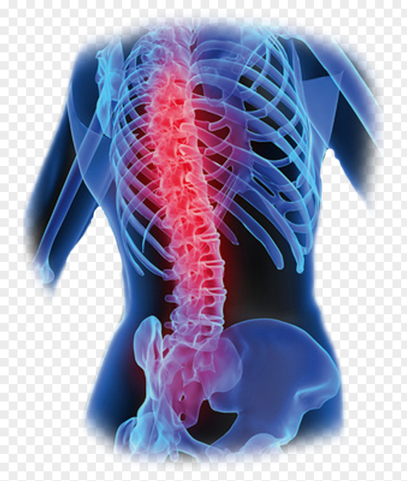 Low Back Pain Vertebral Column Bone Human PNG