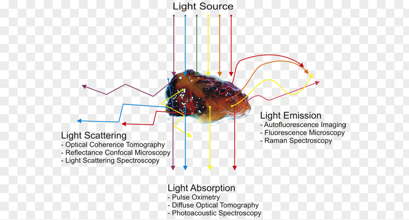 Tattoo Machine Diagram Schematic Light Skin PNG