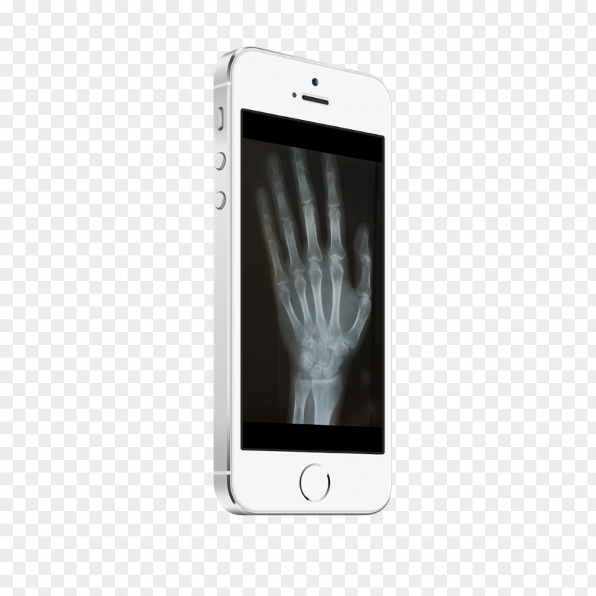 Xray Scanner Smartphone Google Play Mobile Phones PNG