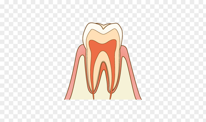 Illust Tooth Decay Dentist 歯科 Therapy PNG