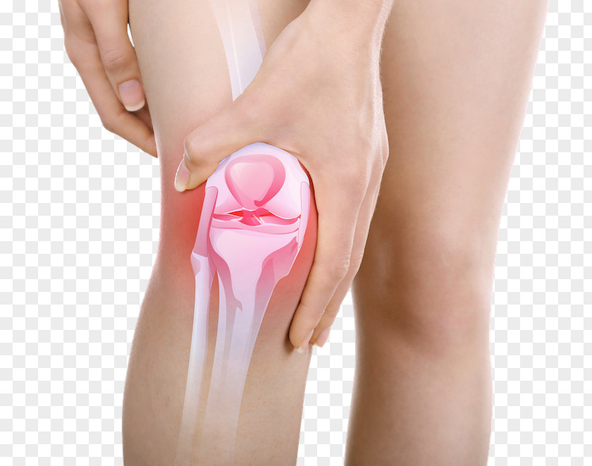 Health Knee Pain Dietary Supplement Joint PNG