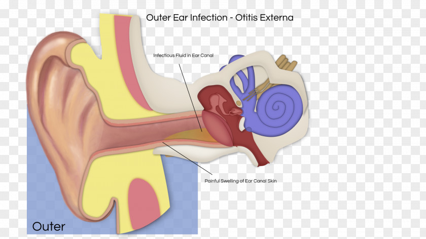 Ear Hearing Otitis Media Vestibular Schwannoma Inner PNG