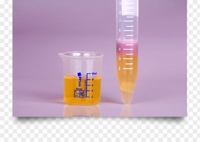 Urinating Clinical Urine Tests Drug Test Kidney Blood PNG