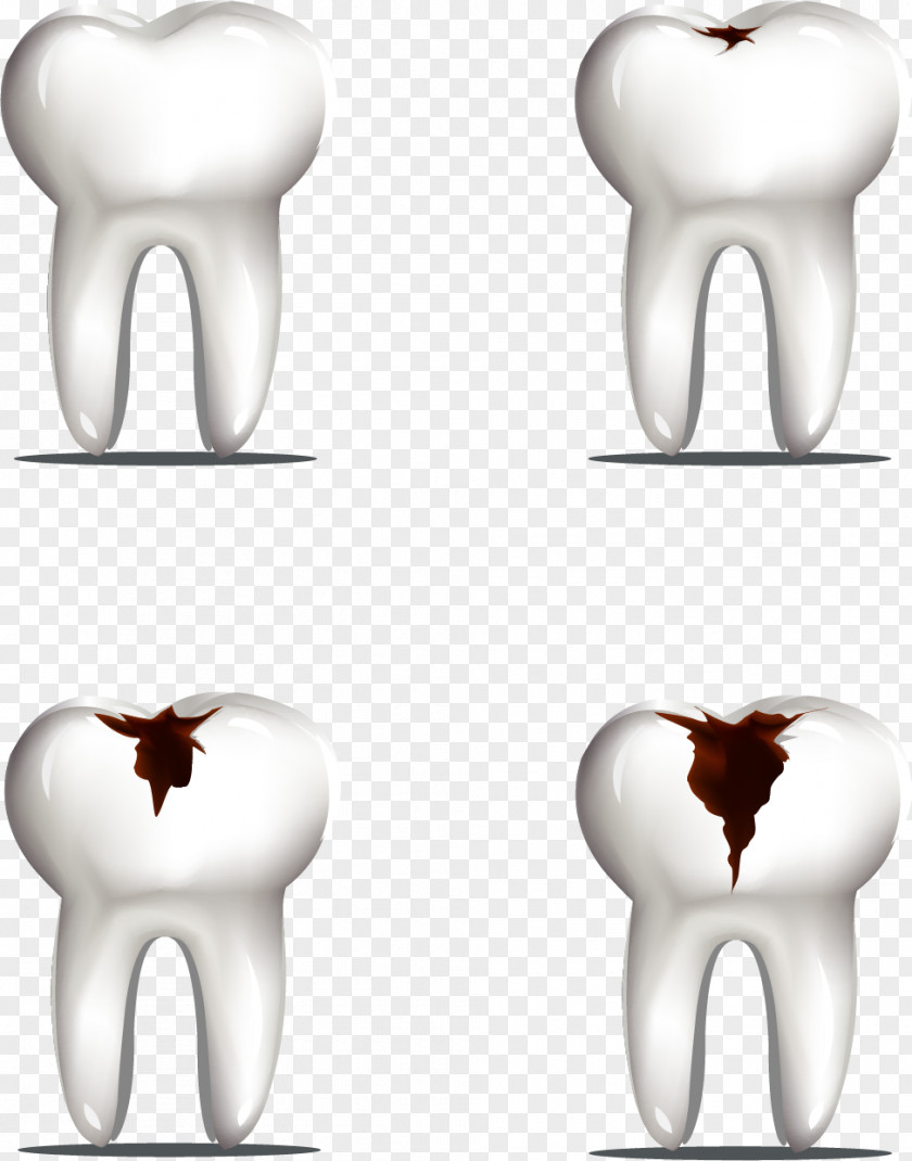 Vector Painted Tooth Decay Molar PNG