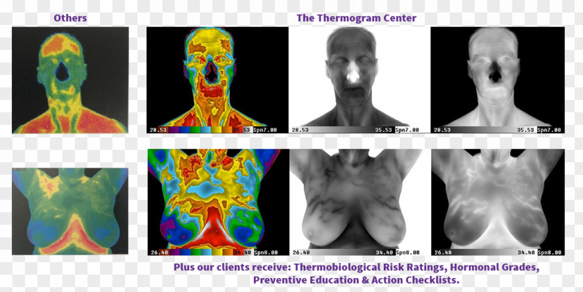 Thermography Medical Imaging Human Body Medicine PNG