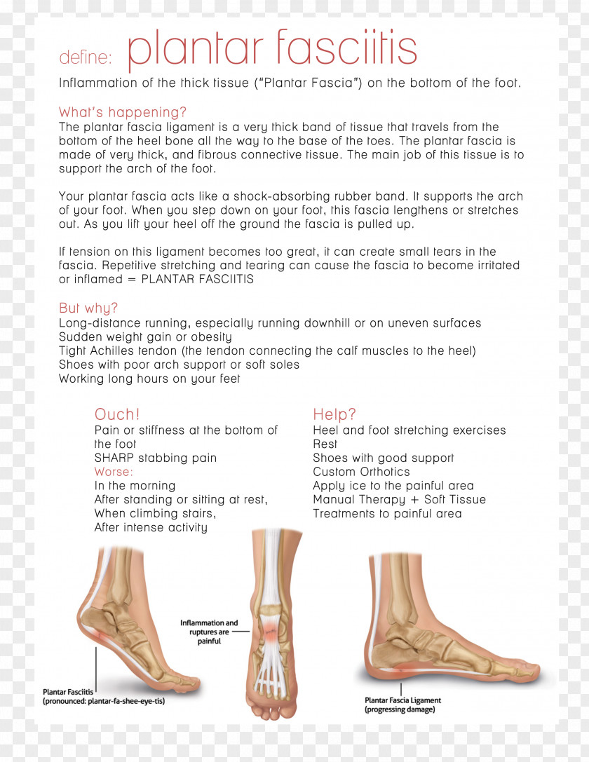 Ball Plantar Fasciitis Fascia Sole Calcaneal Spur PNG