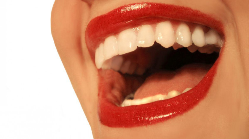 Mouth Smile Cosmetic Dentistry Tooth Whitening PNG