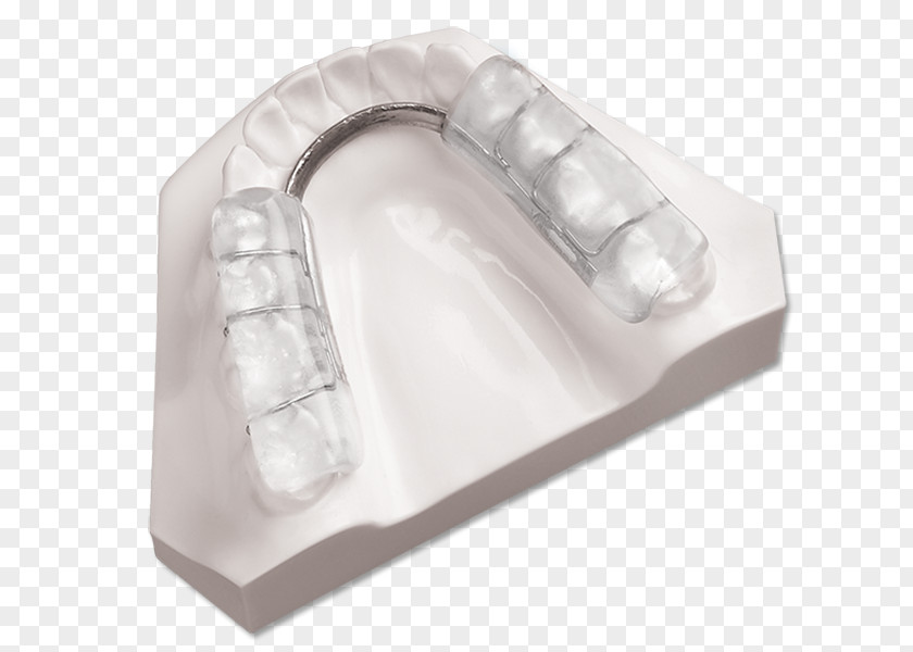 Mandibular Advancement Splints Product Design Splint Orthopedic Surgery Vertical Dimension Of Occlusion PNG