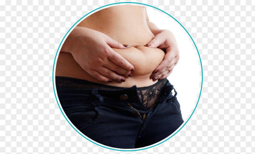 Belly Fat Abdominal Obesity Abdomen Weight Loss Cryolipolysis PNG