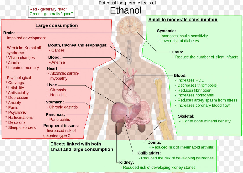 Liver Long-term Effects Of Alcohol Consumption Alcoholism And Health Ethanol Alcoholic Drink PNG