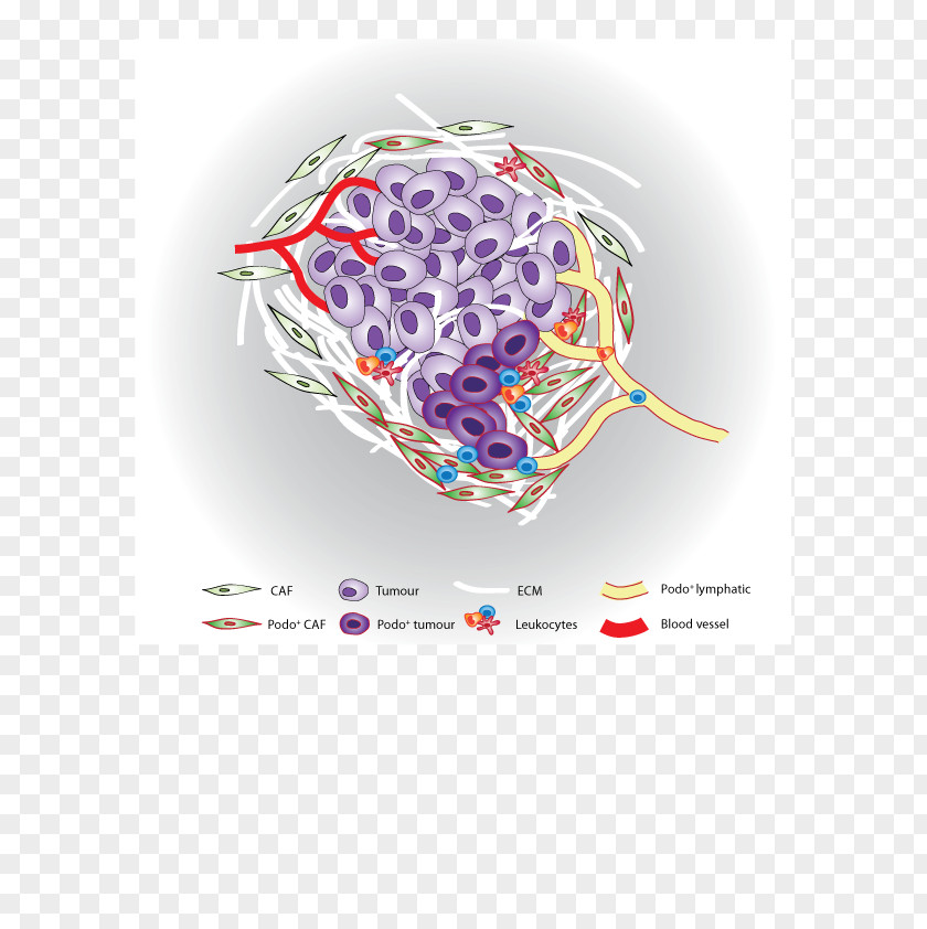 Cancer Cell Of Globular Pathogen Stromal Tumor Microenvironment PNG