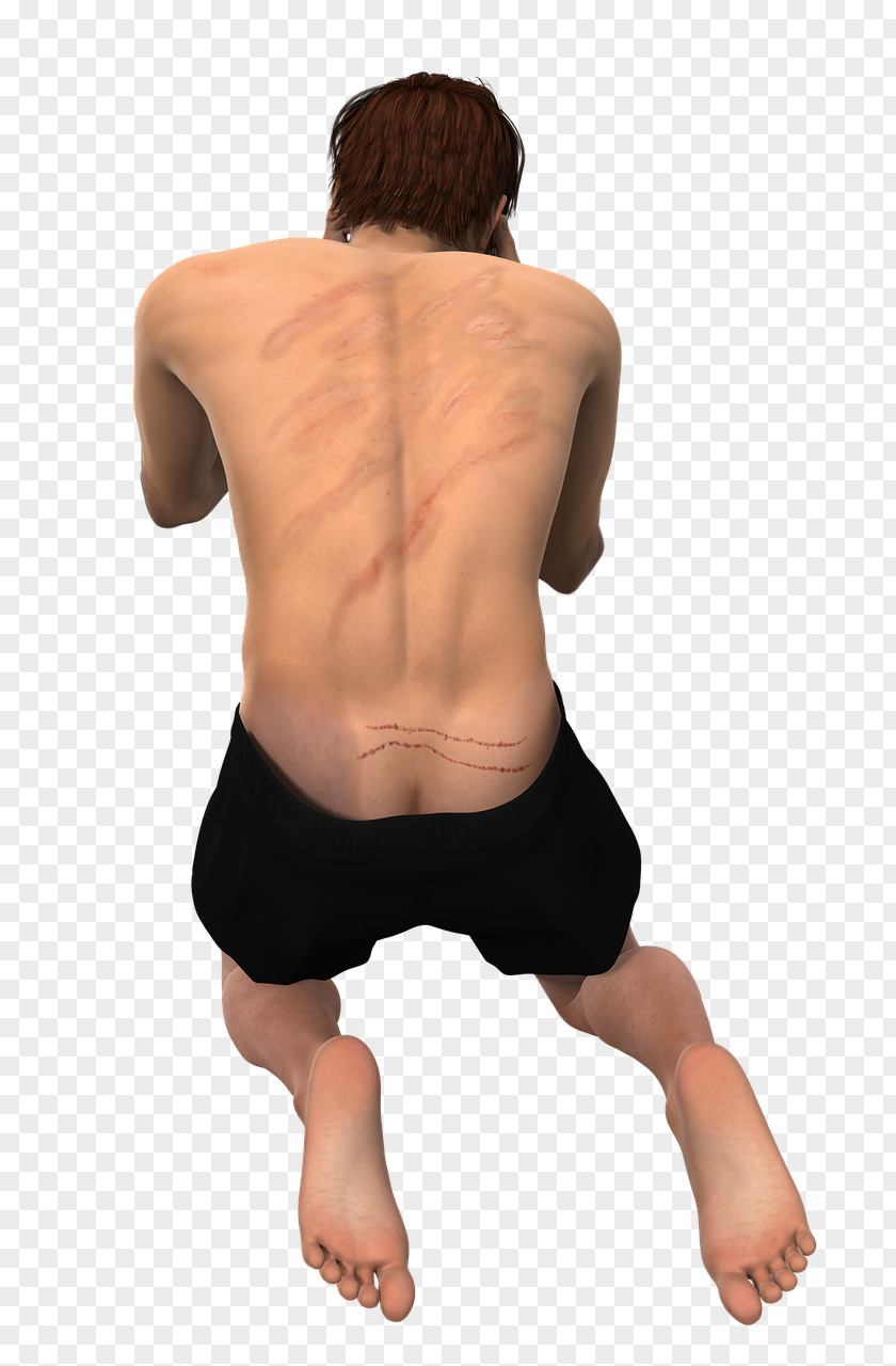 Myositis Human Back Disease Therapy PNG