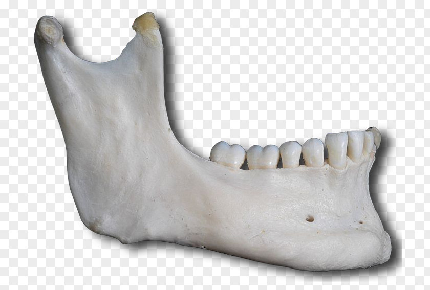 Skull Jaw Mandible Facial Skeleton Bone Anatomy PNG