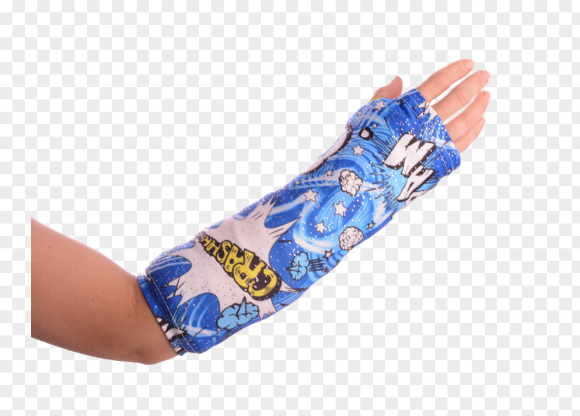 Broken Arm Thumb Orthopedic Cast Bone Fracture Distal Radius PNG