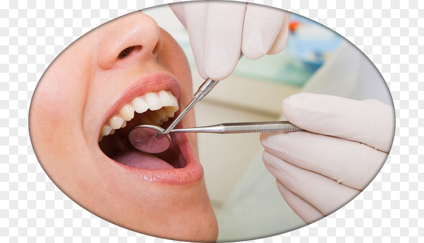 Health Cosmetic Dentistry Dental Surgery Medicine PNG