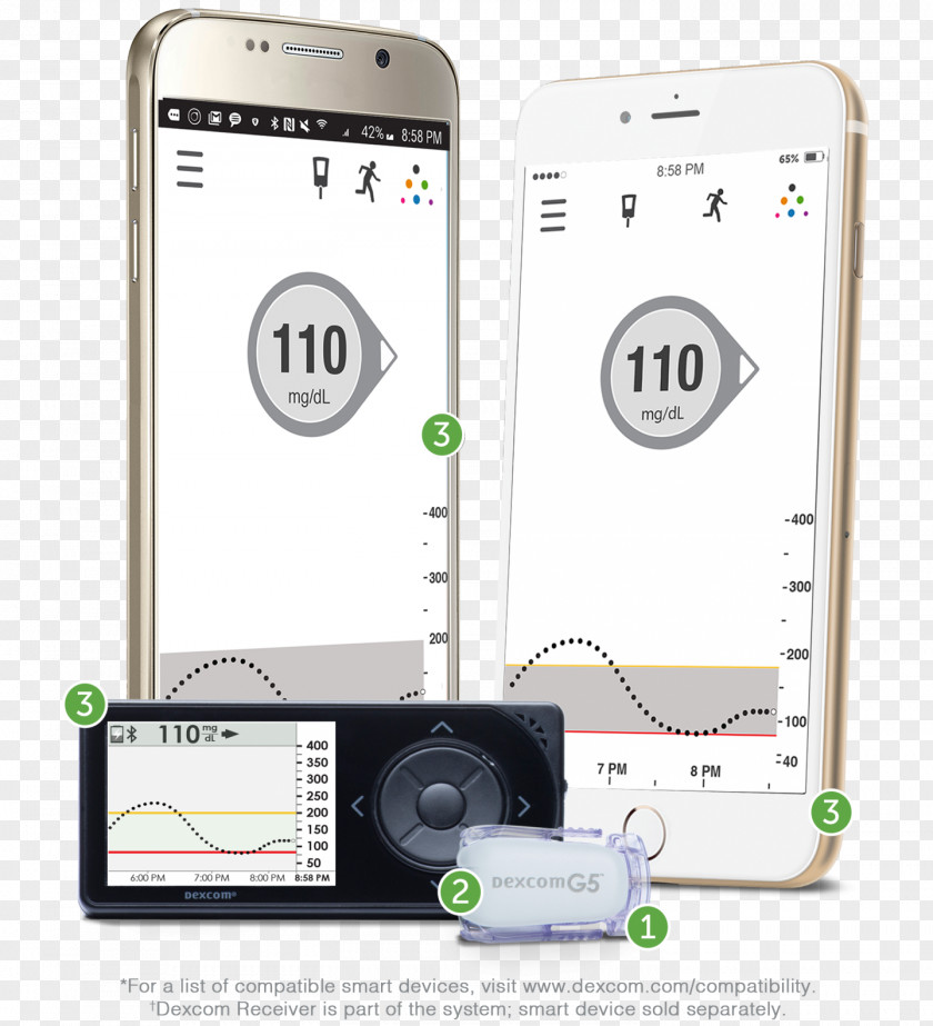 Continuous Glucose Monitor Dexcom Blood Monitoring Diabetes Mellitus Insulin Pump PNG