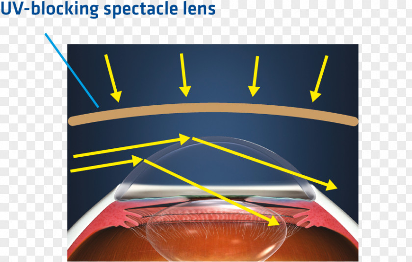 Damage Maintenance Contact Lenses Light UV-B Lamps Glasses PNG