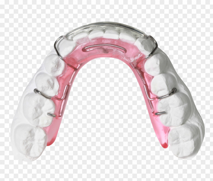Clear Aligners Orthodontics Orthodontic Technology Jaw Bionator PNG