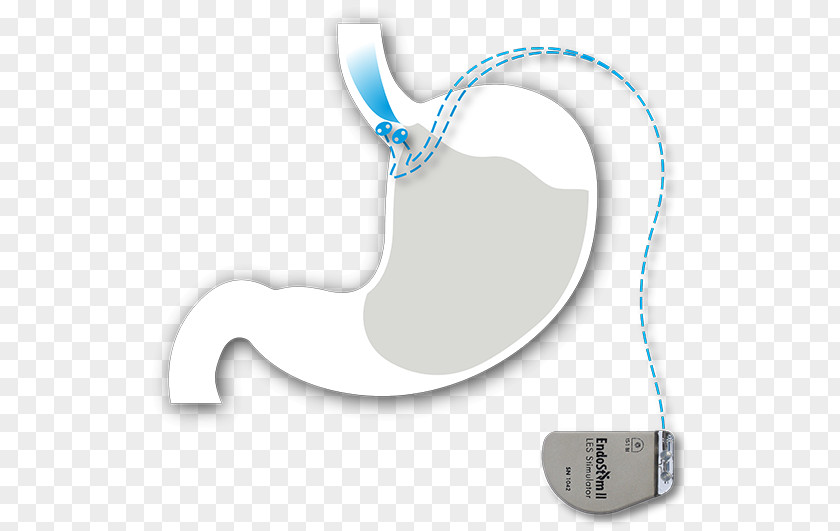 Gastroesophageal Reflux Disease Body Jewellery Font PNG