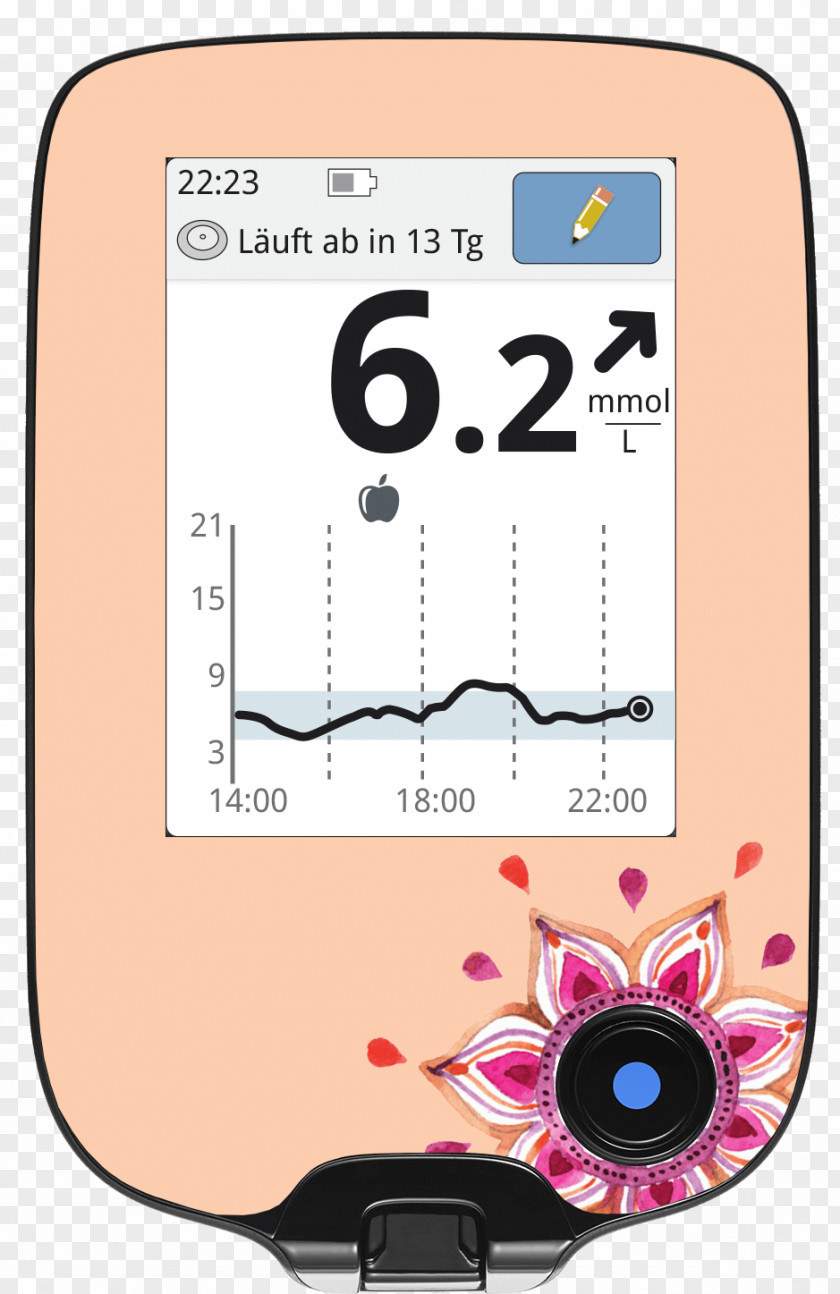 Continuous Glucose Monitor Dexcom Insulin Pump Diabetes Mellitus PNG