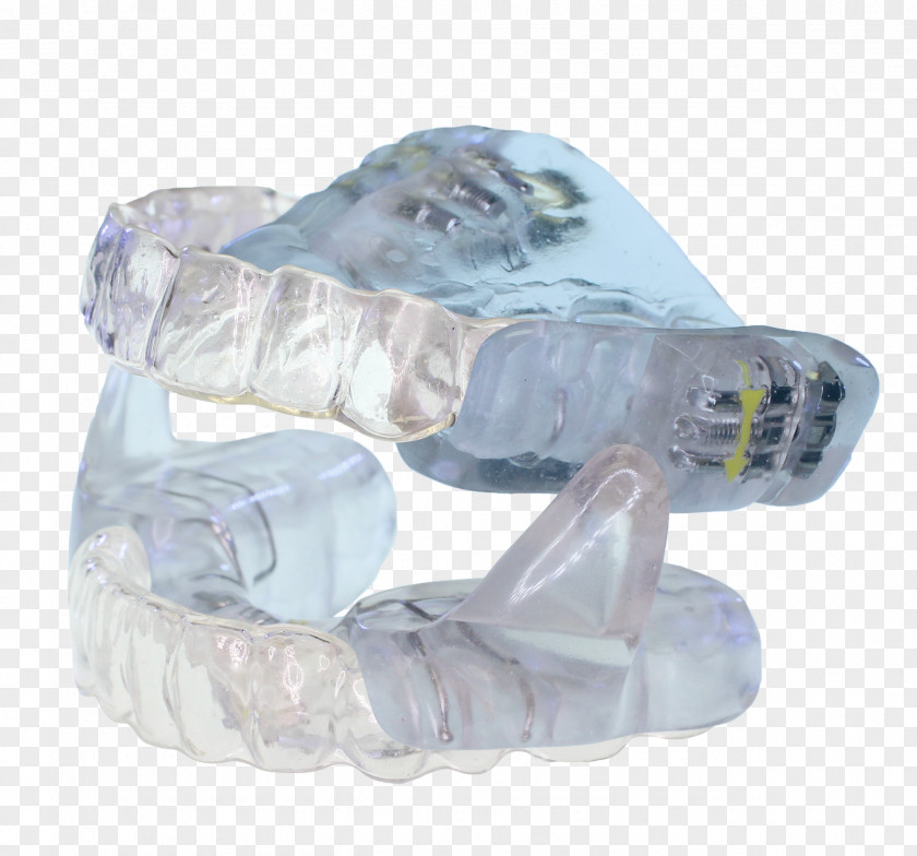 Clear Aligners Mandibular Advancement Splint Sleep Apnea Dentistry PNG