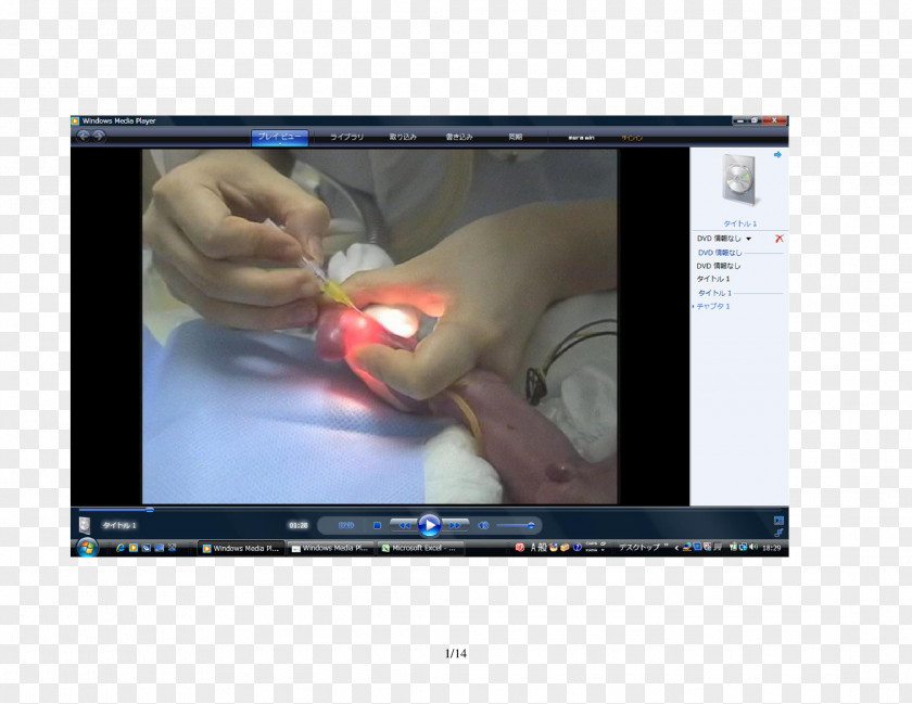 Catheter Computer Monitors Video Finger Multimedia Software PNG