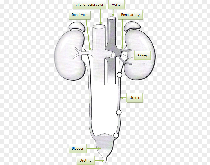 Kidney Failure Product Design Drawing /m/02csf PNG