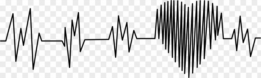 Electrocardiogram Electrocardiography Heart Rate Cardiovascular Disease Medicine PNG