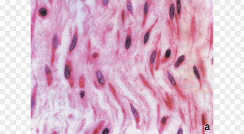 Irregular Border Mesenchyme Connective Tissue Extracellular Matrix PNG