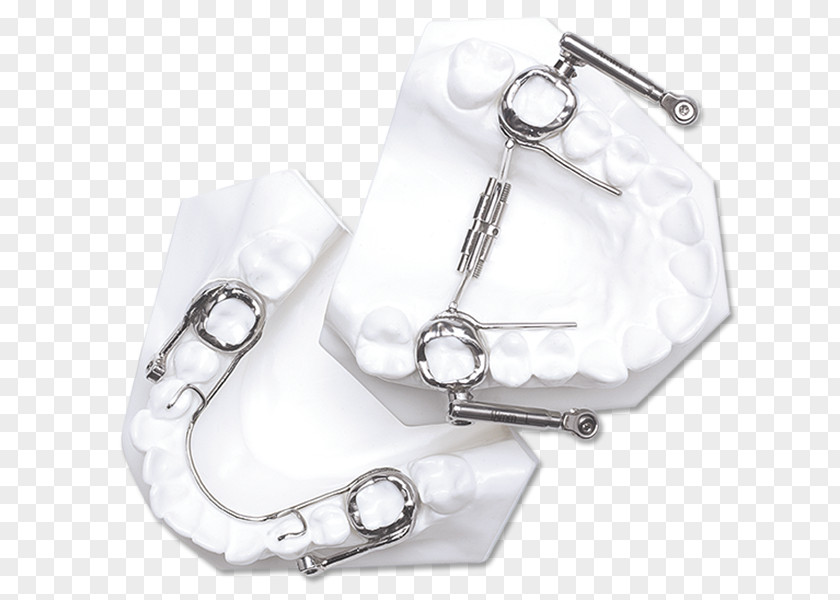 Orthodontics The Herbst Appliance Orthodontic Technology Tooth Mandible PNG