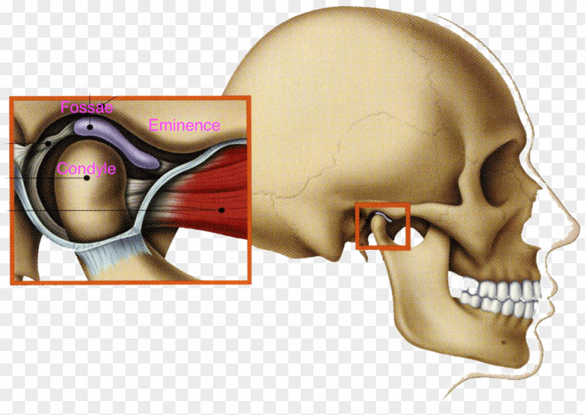 Temporomandibular Joint Dysfunction Mandible Jaw PNG