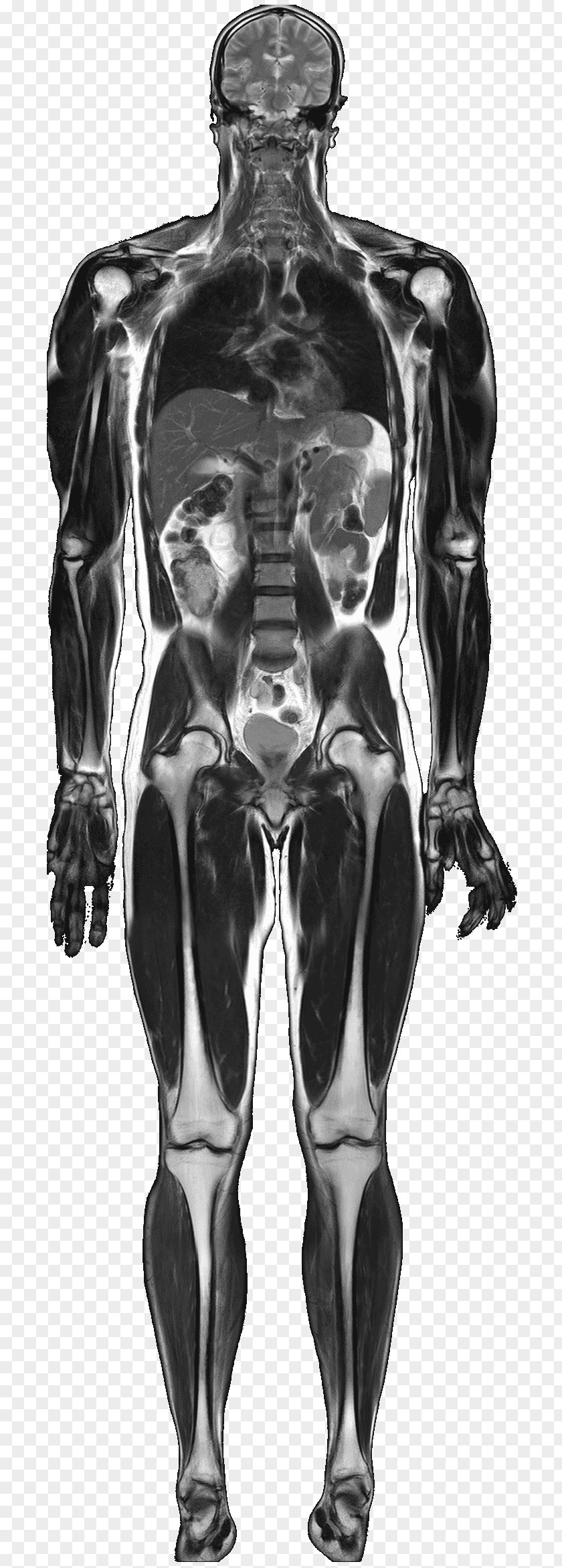 Standard Body Magnetic Resonance Imaging Medical Anatomy Human Nuclear PNG