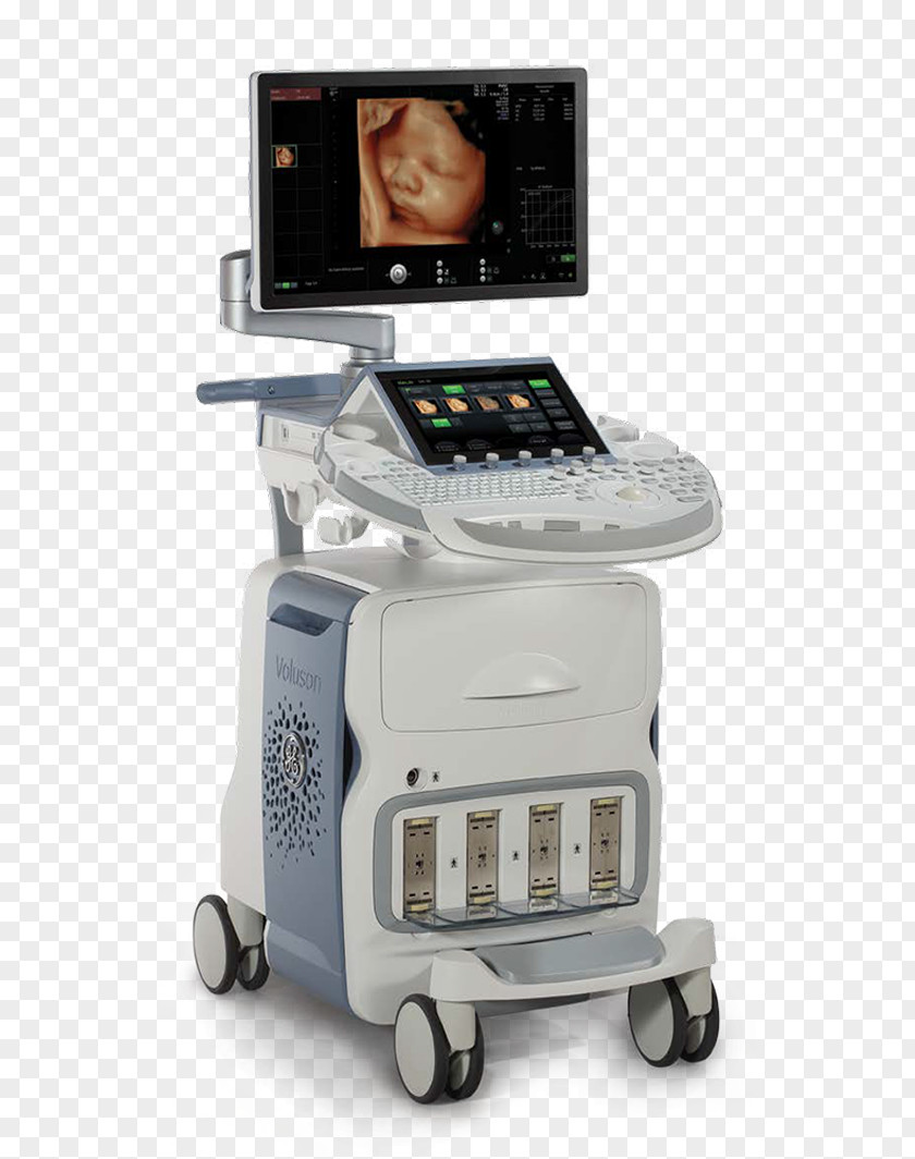 Voluson 730 GE Healthcare 3D Ultrasound Ultrasonography PNG