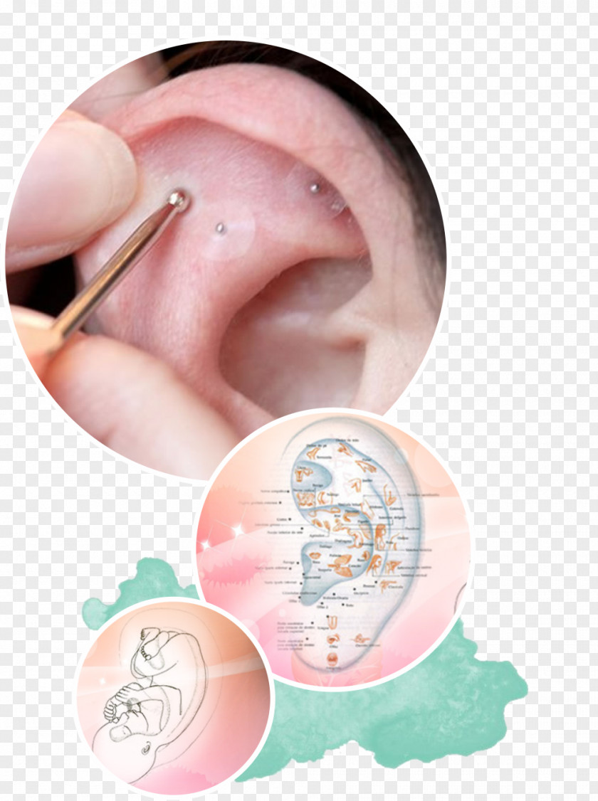 Ear Auriculotherapy Acupuncture Auricle PNG