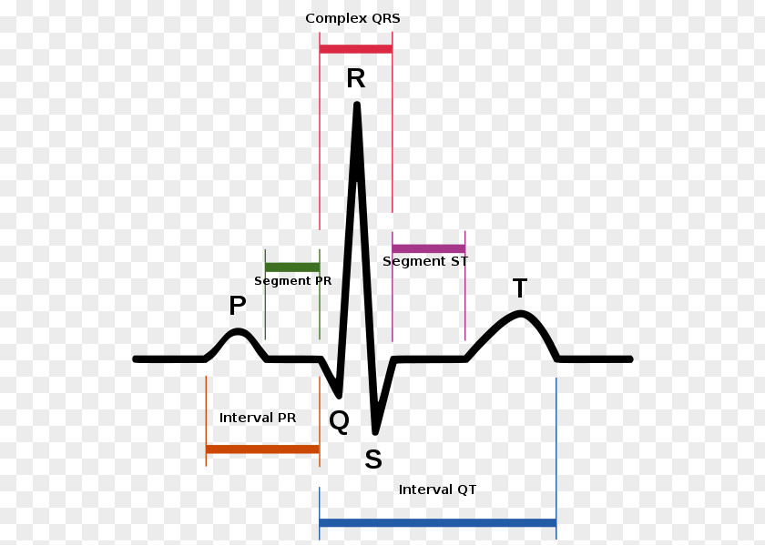 Heart Sinus Rhythm Electrocardiography Rate Tachycardia PNG