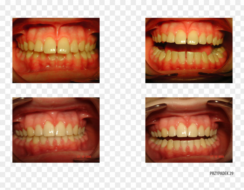 Orange Polska Tooth Patient Therapy PNG