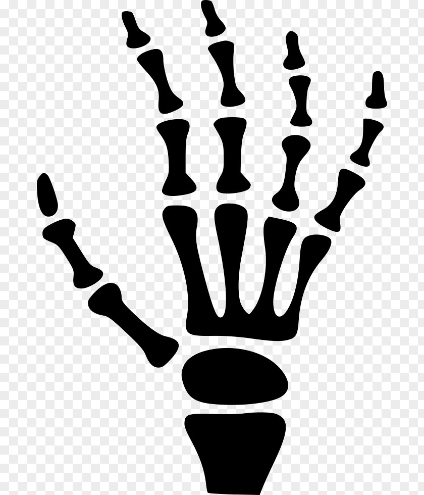 Hand Carpal Bones Human Skeleton PNG