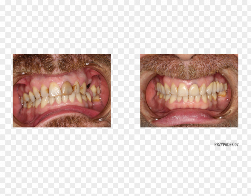Medycyna Estetyczna Dr. Brett Egelske Lombard Street Jaw Dentistry Yelp PNG
