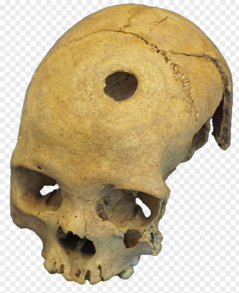 Skeleton University Of Basel Tautavel Man Snout PNG