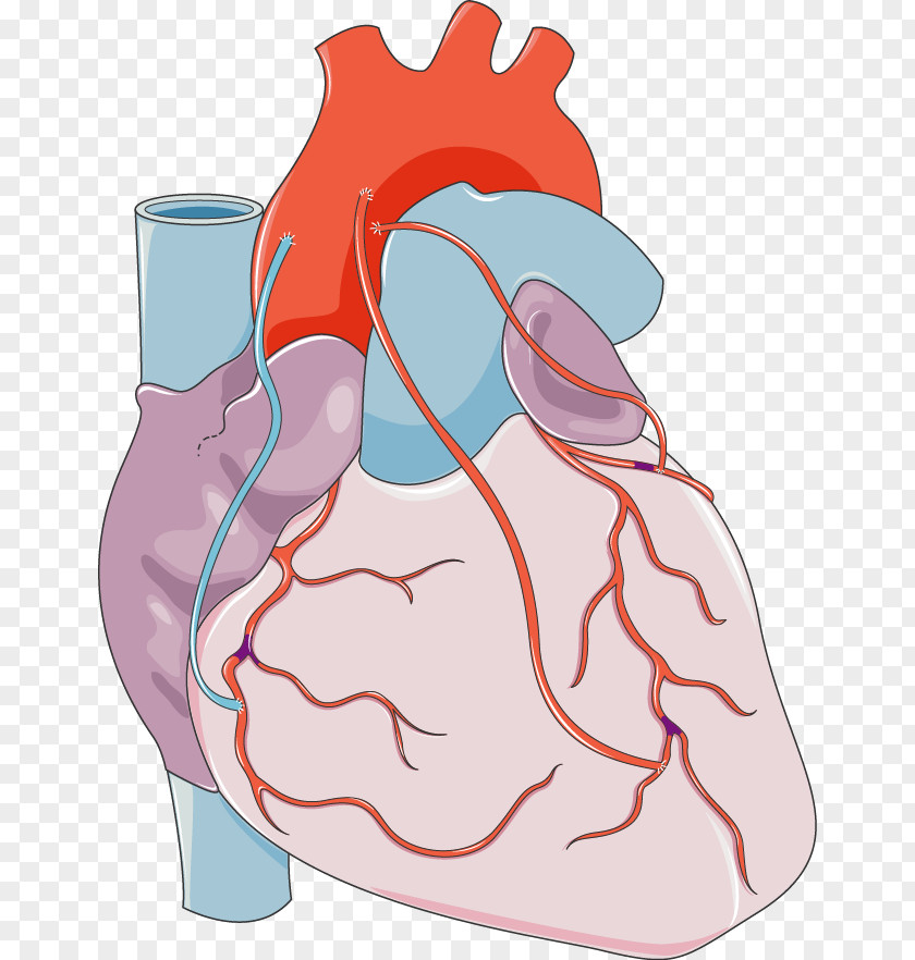 Heart Coronary Artery Bypass Surgery Vascular Arteries PNG