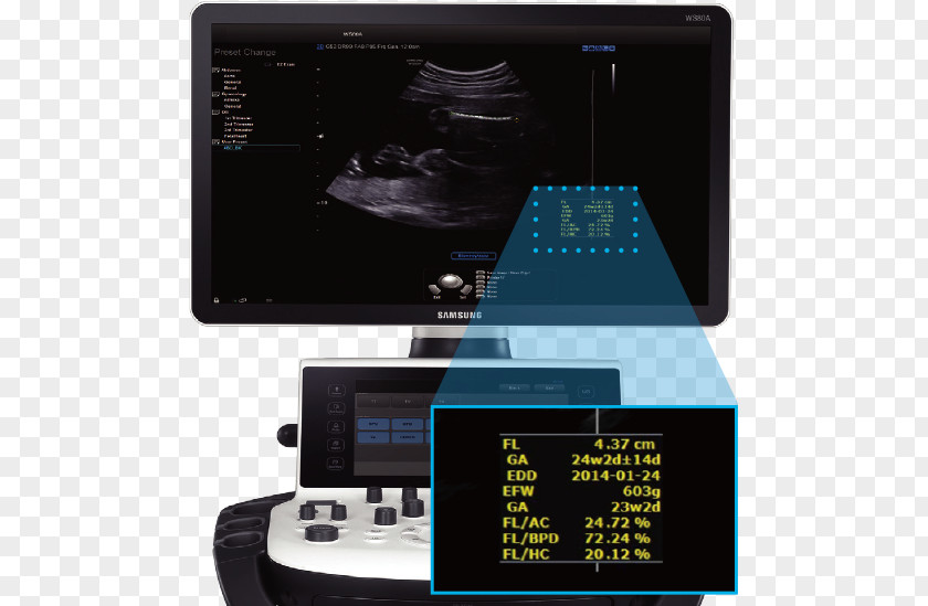 Samsung 3D Ultrasound Medison Ultrasonography Consumer Electronics PNG