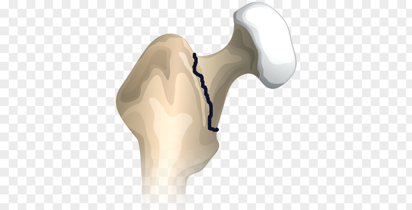 Design Thumb Hip Shoulder PNG