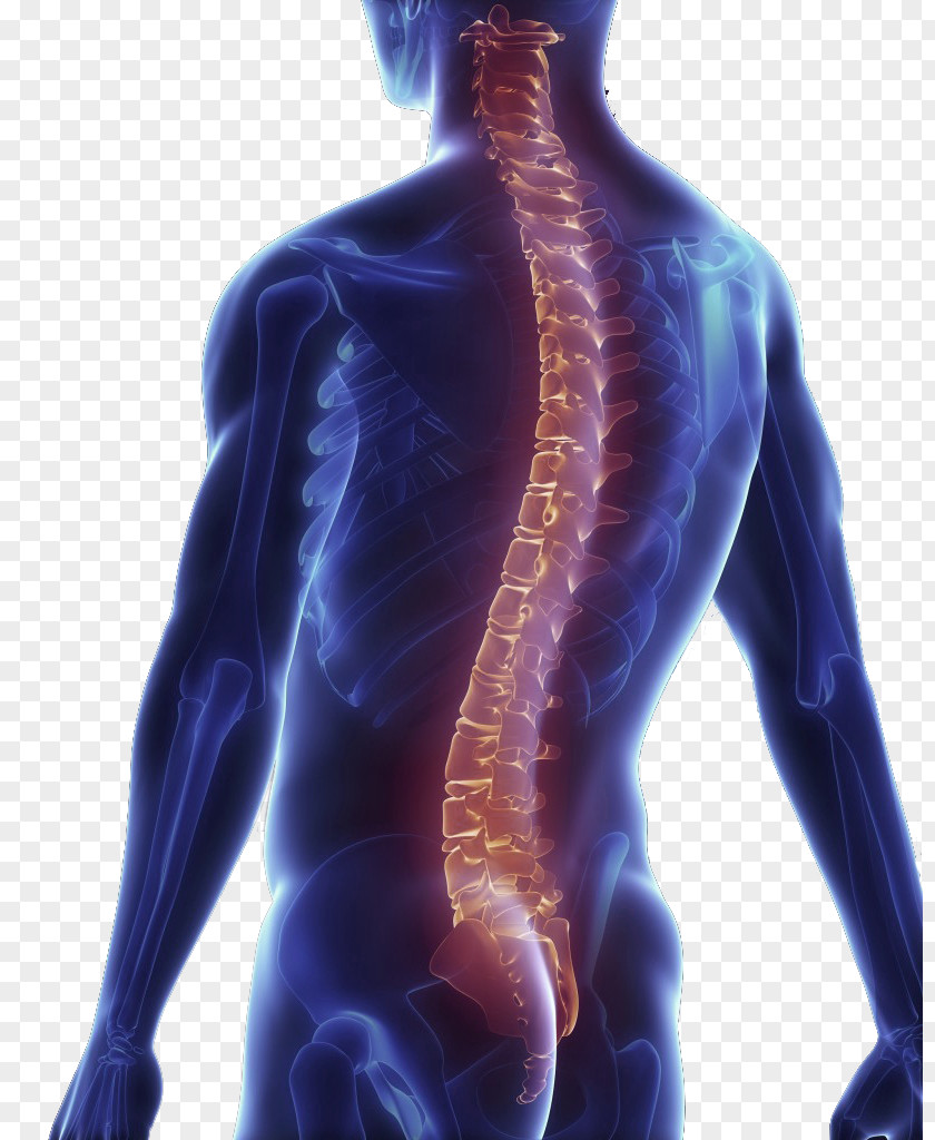 Back Pain Vertebral Column Surgery Spinal Decompression Human PNG