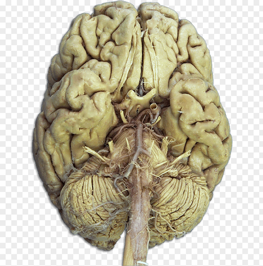 Anatomy Cranial Nerves Brain Nervous System PNG