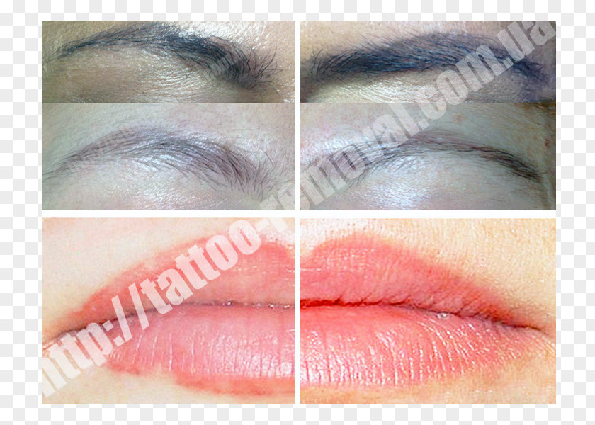 Tattoo Removal Permanent Makeup Scar Eyelash Extensions PNG