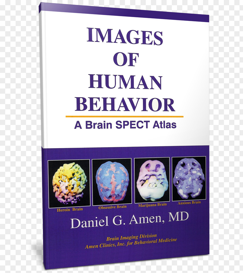 Human-behavior Images Of Human Behavior: A Brain SPECT Atlas Change Your Brain, Life Amen Clinics Making Good Great Amazon.com PNG